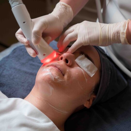 RF Fascia Sculpting Therapy