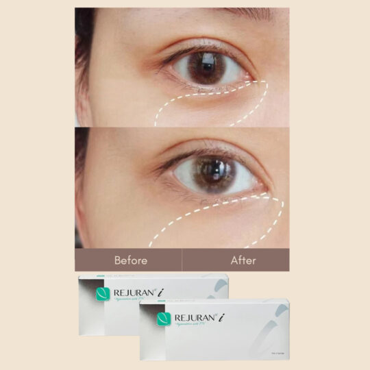 Rejuran White Under Eye