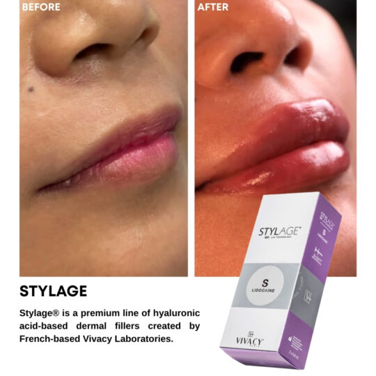 Filler - Stylage