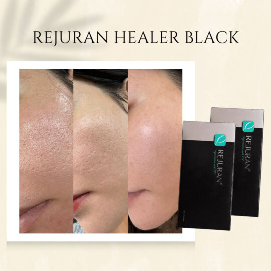 Rejuran Healer Black